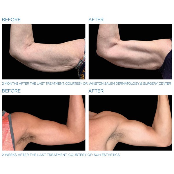 FCSkinSolution's tweet photo. Reach your body goals! 💪

Click here for more information: https://t.co/8QoOXfVET2 

Click here to book a consultation: https://t.co/2ExuTyWQlK 

📌 Visit us at 660a Leg in Boot Square, Vancouver BC
✉️ info@fcskinsolution.com
📞 604-877-1299
#vancouver #vancouverbc #beautyclinic https://t.co/I0KFstT1q8