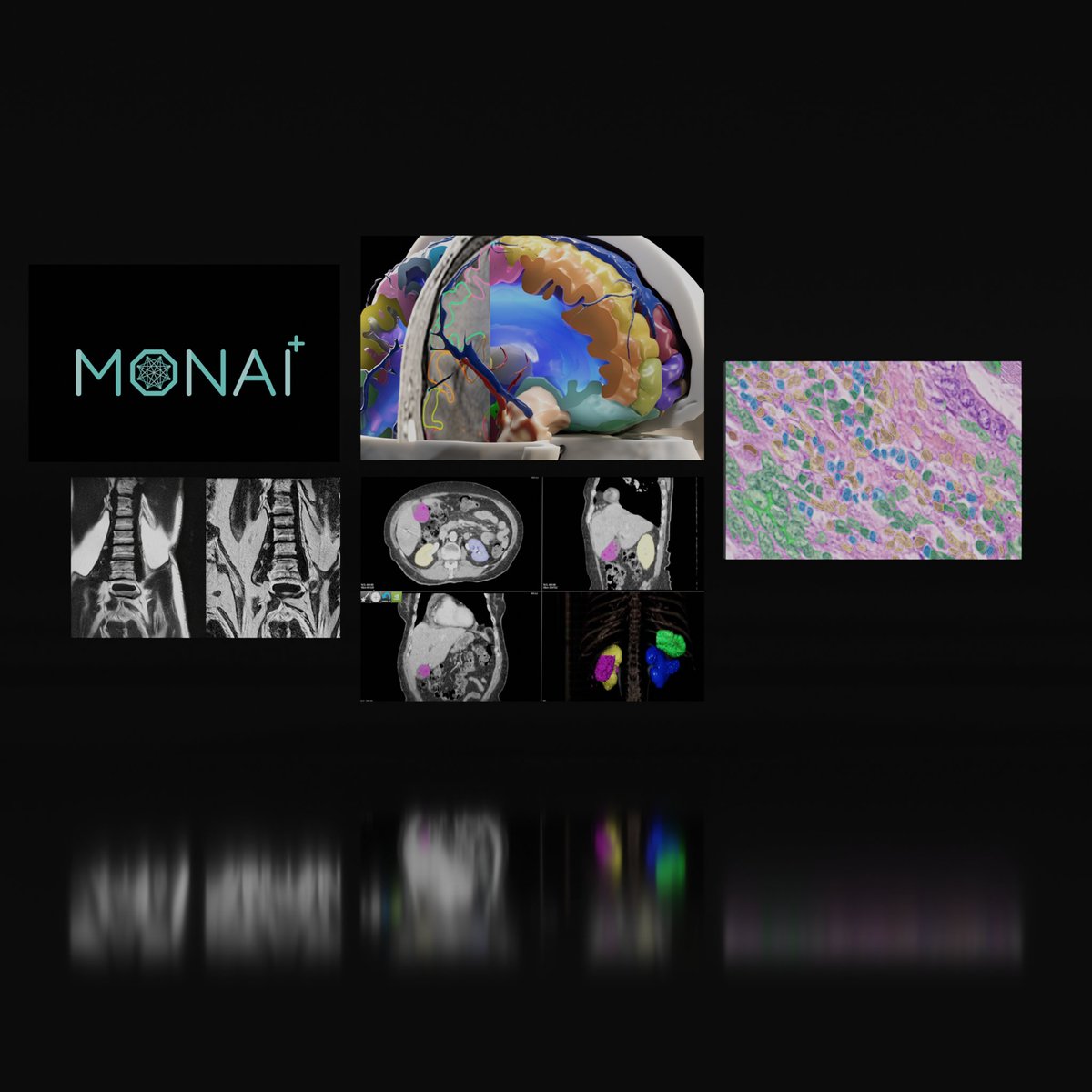 NVIDIA Healthcare (@nvidiahealth) on Twitter photo The 1 million mark represents a major milestone for the medical open network for AI, which has powered numerous research breakthroughs and introduced new developer tools in the last year. <a href="/ProjectMONAI/">ProjectMONAI</a> #healthcare #GTC23
nvda.ws/42AlQyL The 1 million mark represents a major milestone for the medical open network for AI, which has powered numerous research breakthroughs and introduced new developer tools in the last year. <a href="/ProjectMONAI/">ProjectMONAI</a> #healthcare #GTC23
nvda.ws/42AlQyL