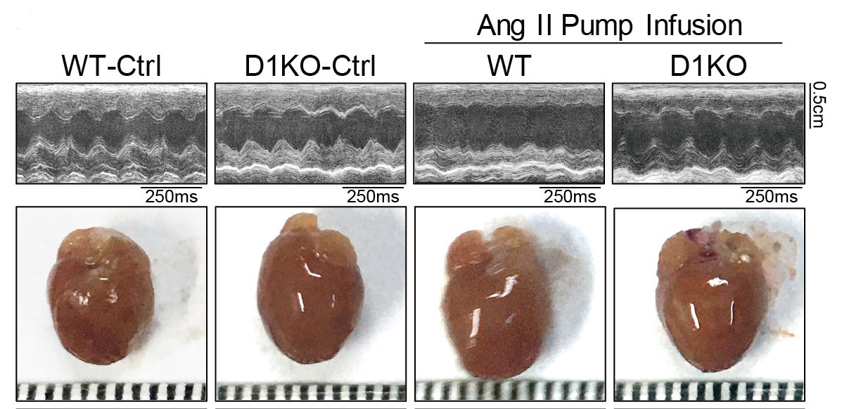 CircRes's tweet photo. Ye &amp; colleagues discovered that #AngII directly interacts with macrophage #Dectin-1 to induce an inflammatory response, resulting in cardiac inflammatory cell infiltration, remodeling, &amp; dysfunction. Learn more at https://t.co/Rg9IYboYoj     
@MdHuang @ZKI_China @none https://t.co/gKbFo8mOUU