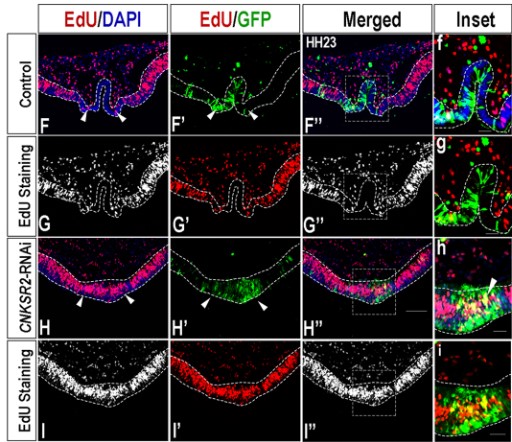 the_Node's tweet photo. New on the Node!
@NivedaUdaykumar shares the behind the paper &amp; scicomm story on their research describing the role of CNKSR2 in chick forebrain patterning &amp; morphogenesis.
Check out their educational videos in English, Hindi, Tamil, Nepali and Bengali!

https://t.co/F0PapD76PB https://t.co/94PTKbz37j