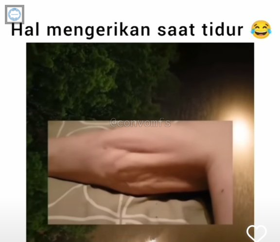 convomfs's tweet photo. 🤍 kalian pernah kena kram betis pas tidur???? aku pernah dan itu beneran sakit bgt yah ternyata🥲 https://t.co/ar2KeZZATC