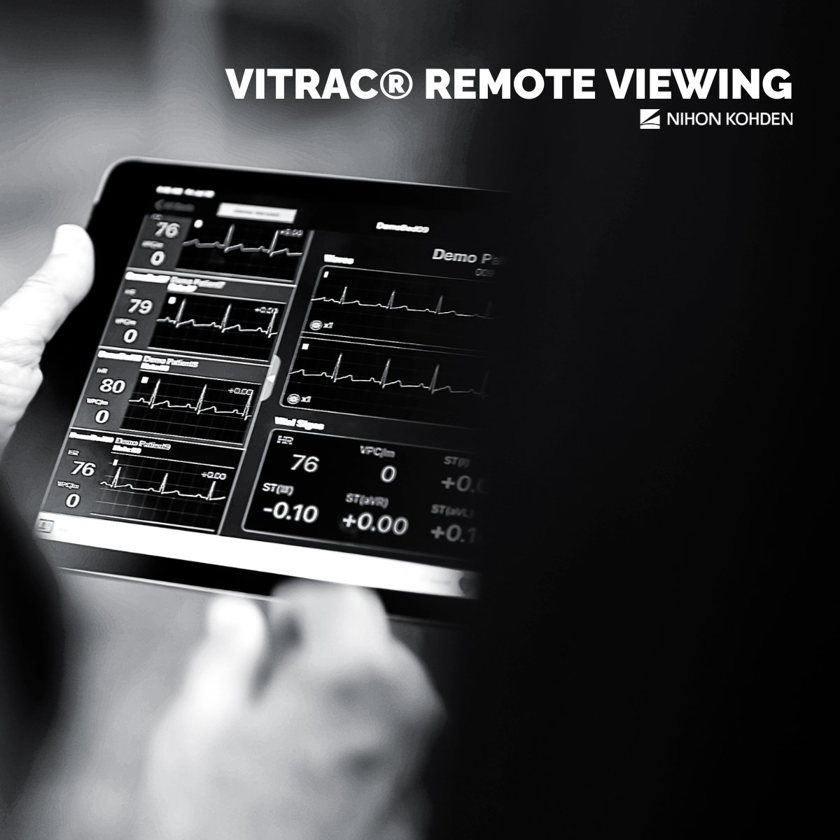 Connect anywhere, anytime with the ViTrac remote viewing app. Designed for secondary viewing, the application includes all required software to provide clinicians with secure remote access to patient data. Learn more here: b.link/8yazku