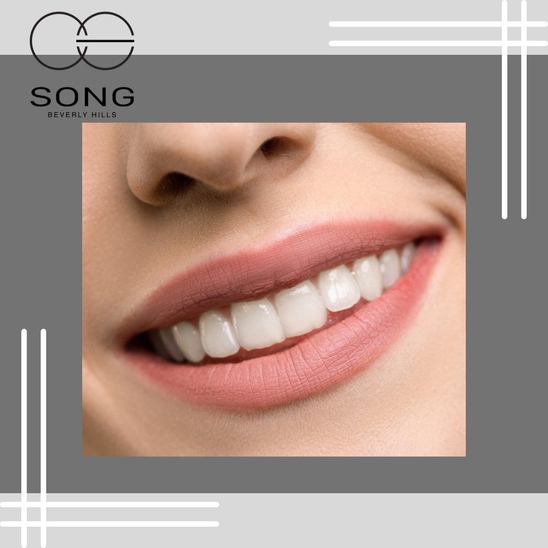 SongDentistry's tweet photo. While composite veneers are a little bit more affordable than porcelain veneers, composite veneers tend to look more unnatural and are prone to staining over time, which results in needing to have them replaced more frequently. https://t.co/z7J0a6uMc2