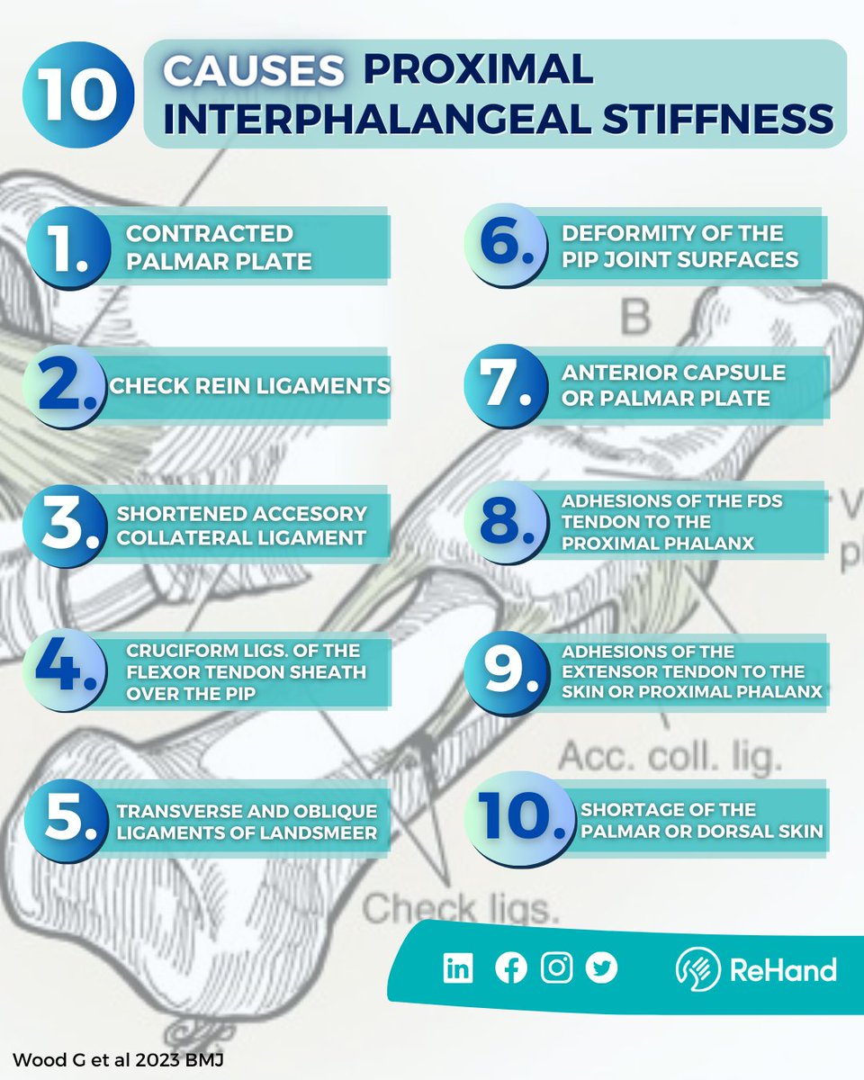 ✌️PIP Stiffness | Part 1 Causes✌️

Joint stiffness, particularly PIP, is a real headache🥵 for hand surgeons and therapists

📌In order to treat it correctly we need to know WHAT is causing it.

Here is 1⃣0⃣ possible causes👇