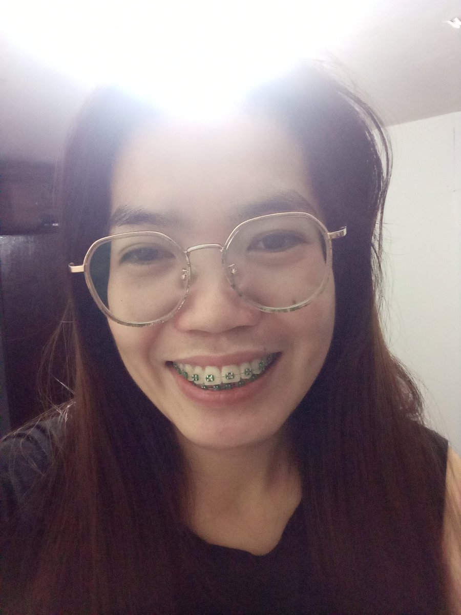 Rolieme22's tweet image. 98th day of braces 😁

#overbite