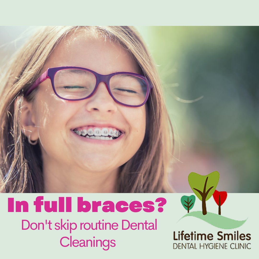 During orthodontic treatment, especially full metal wires &amp; brackets, it is important to meticulously remove plaque bacteria buildup.  Plaque causes an acid attack, which can lead to permanent white or brown spots on tooth enamel. 
🪥🦷 Do not skip routine dental cleanings