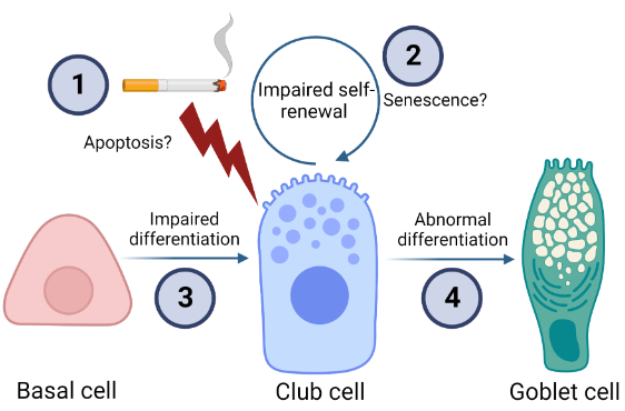 APSPublications's tweet photo. New in @AJPLung! An Update in Club Cell Biology and Its Potential Relevance to Chronic Obstructive Pulmonary Disease (Blackburn et al.)
https://t.co/Fwy5QlhGNY
@BradWRichmond @VUMChealth @bcmhouston @Uni_Newcastle #COPD #ClubCells https://t.co/iuYBwZfe2i