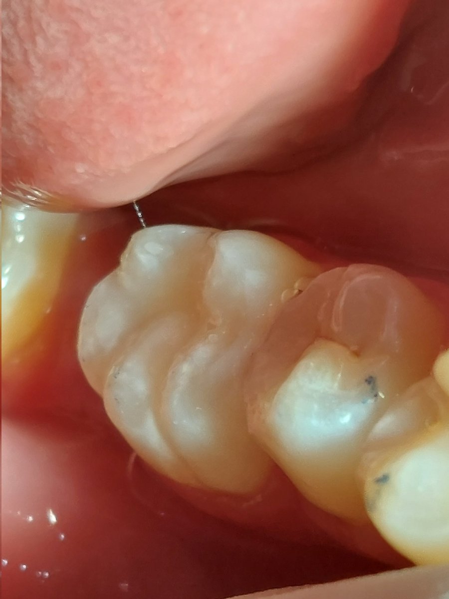 Sara62433201's tweet photo. ثروتي🦷 https://t.co/z6ab10fQRF