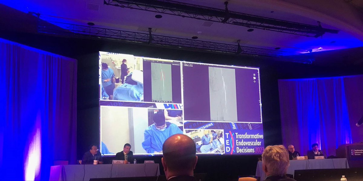 AngioDynamicsCV's tweet photo. Can you believe these results?! These images are from a live case at the TED Conference in Scottsdale, AZ featuring the Auryon Atherectomy System, performed by Dr. Ramaiah using a 1.5mm Auryon catheter. Thank you, Dr. Ramaiah! #ThisChangesEverything #PAD #Auryon https://t.co/lMrGeBAWbc