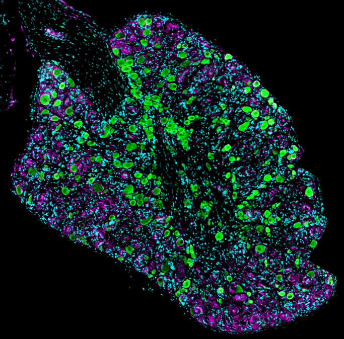 Andi McClatchey tweet media