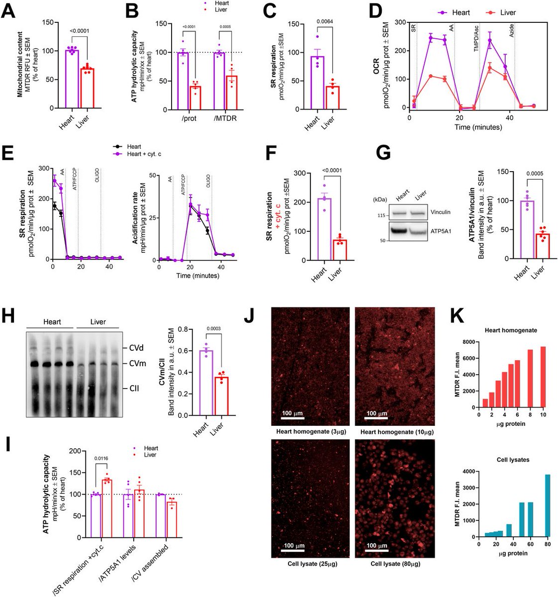 LifeScienceAlliance (@lsajournal) on Twitter photo Fernandez-del-Rio et al. demonstrate a Novel Approach to Measure Complex V ATP Hydrolysis in Frozen Cell Lysates and Tissue Homogenates. <a href="/OrianShirihai/">Orian Shirihai</a>
life-science-alliance.org/content/6/4/e2… Fernandez-del-Rio et al. demonstrate a Novel Approach to Measure Complex V ATP Hydrolysis in Frozen Cell Lysates and Tissue Homogenates. <a href="/OrianShirihai/">Orian Shirihai</a>
life-science-alliance.org/content/6/4/e2…