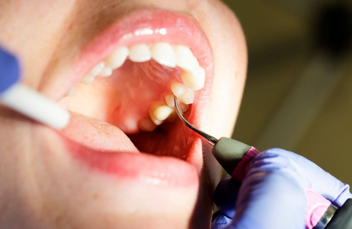 ChicagoPacific's tweet photo. According to new findings, oral health awareness improved when #DentalCare was incorporated into well-child visits. via @ClinicalAdvisor #Dentistry https://t.co/gXgz4ycGDi https://t.co/hA4subPnUG