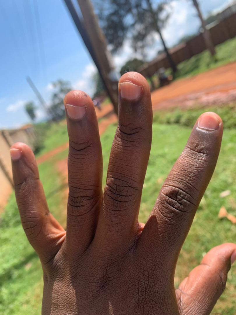 JacksonFrobix's tweet photo. Obulungi bunuma https://t.co/atMhgoAOo2