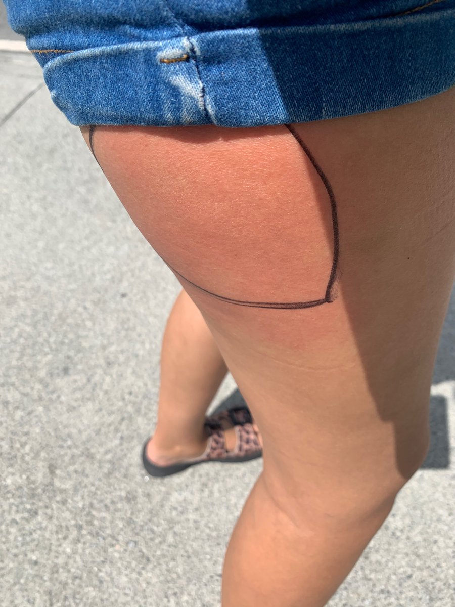 lufafaria's tweet photo. hoje fiz um procedimento na coxa e sem perceber andei com as marcações com caneta na rua 😍🤡 https://t.co/5rUuFmwaJu