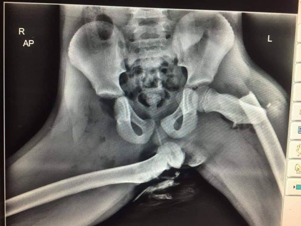 ClaudetteGGibs1's tweet photo. And this ladies and gentleman is why you keep your feet off of the dashboard while riding in a car. Airbags deploy at 100-220 mph. https://t.co/eU6SlYdKCp