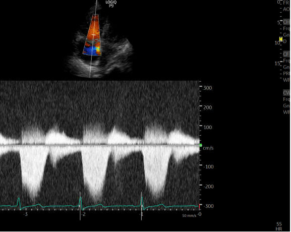 Ahmed T Abdellah on Twitter: 