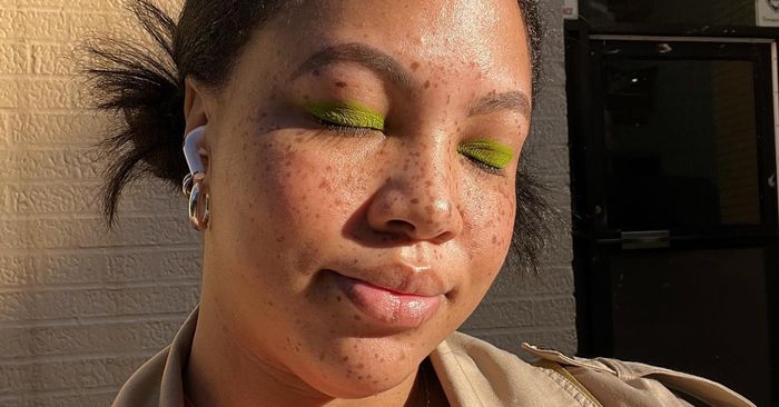 iamavail's tweet image. Derms say understanding why your skin is oily is key. Board-certified dermatologist Lauren Penzi, MD explains our skin naturally produces sebum oil for... #skincare #dermatology #oilyface u.eblz.co/LDtV8YAcX