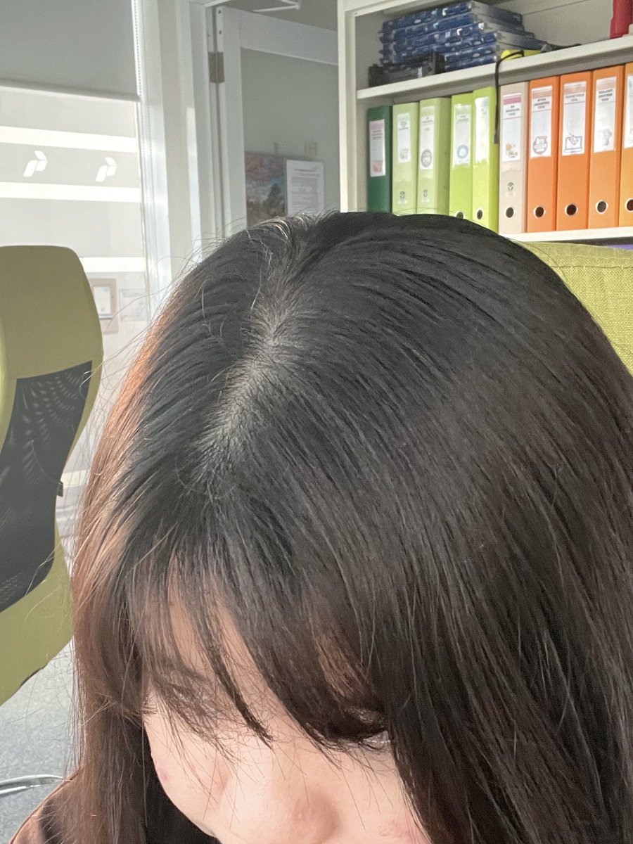nocturnalcutie's tweet photo. as someone who has oily scalp &amp; hair, happy bgt liat rambut masih bervolume gini di hari ke-2 setelah keramas. biasanya hari ke-2 tuh udah keliatan lepeknya.

ganti ke shampoo yg khusus buat oily hair deh guys, it works on me<3 https://t.co/NXJDeHE2DC