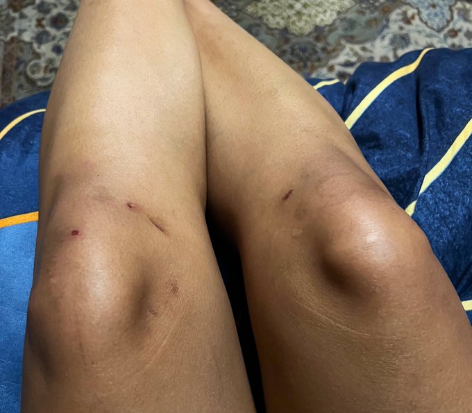 These are the knees of a bitch who works hard to keep you entertained. https://t.co/RvQgFl7egE