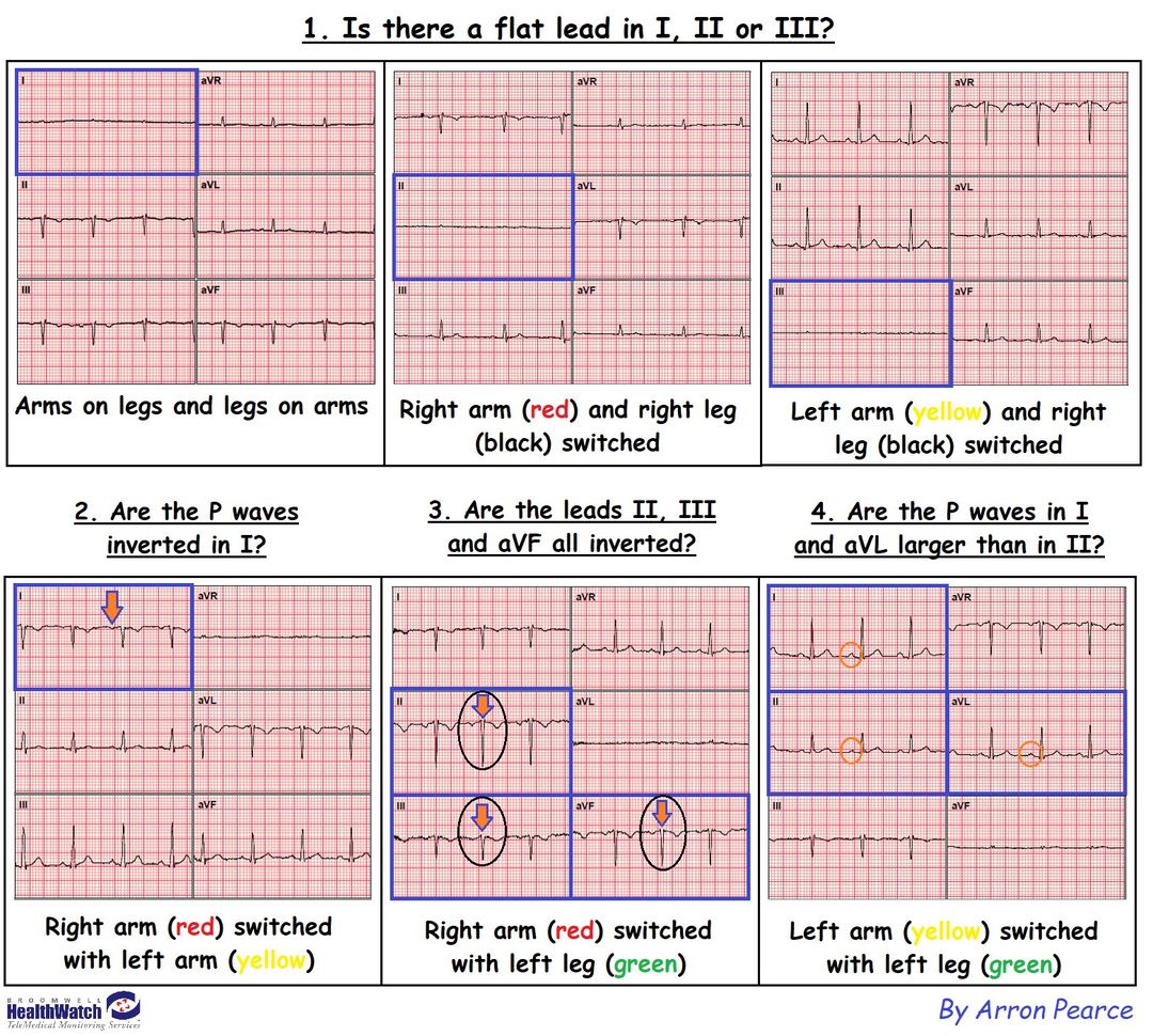 Arron Pearce tweet media