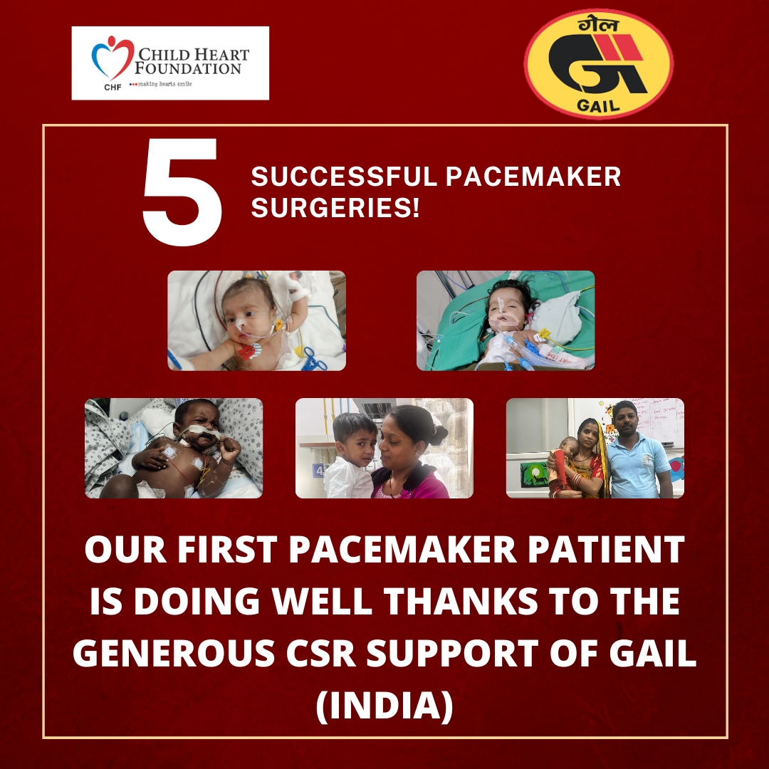 ChildHeartFndn's tweet photo. We're thrilled to share that our CSR partnership with @gailindia has supported 5 life-changing pacemaker surgeries. Thank you, GAIL, for your unwavering commitment to making a difference. Together, we're building a brighter future for everyone. #CSRPartnership #grateful 🧵 https://t.co/bTtsPIeLfK