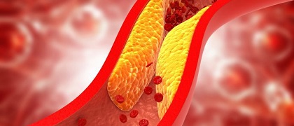 Danish Cardiovascular Academy tweet media