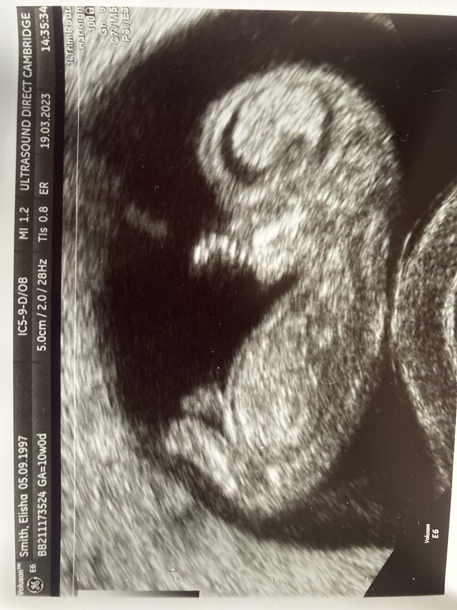 Valk_212's tweet photo. So a couple of things it’s been ages since I’ve posted on here.. I still think about all my friends I’ve made gaming and I really wish you all the best and hope you are all living your best lives. Also wanted to let all you guys know I’m guna be a dad!!! 😁 https://t.co/4lSNFjXH6h