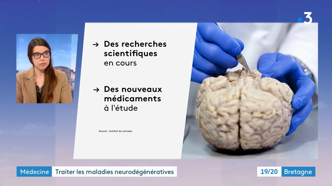 SemCerveau35's tweet photo. [En replay] Reportage @france3Bretagne sur la start-up @mind_dig avec @MahmoodHacan &amp; le Prof. Marc Vérin, et le Dr @Manon_Auffret en plateau en marge de la @Semaine_Cerveau 2023 ! Merci pour l'accueil 🤩
📺A 12:45: https://t.co/OVRJk5TcPP https://t.co/hrz1YLPtZJ