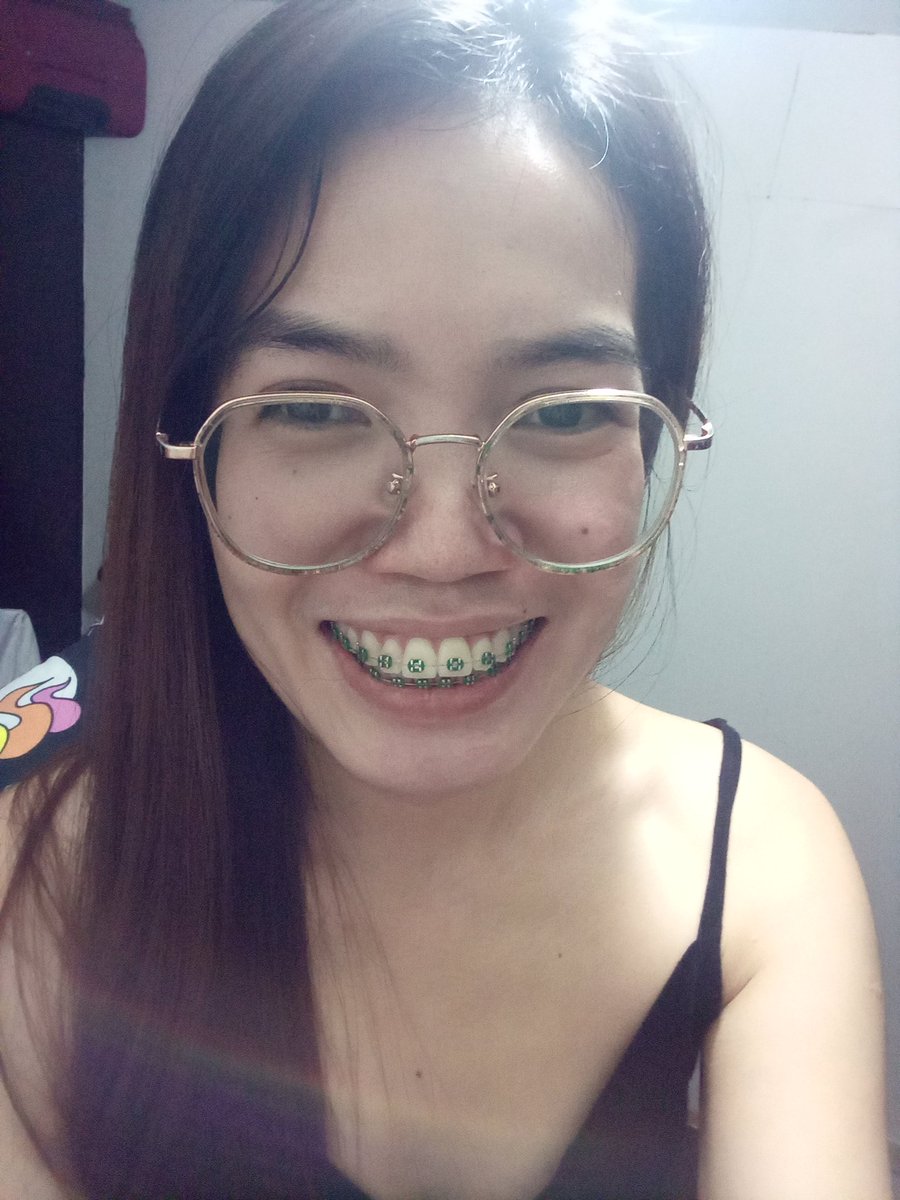 Rolieme22's tweet image. 99th day of braces 😁

#overbite
