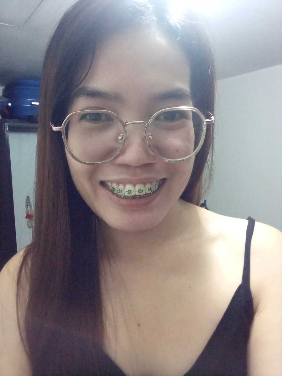 Rolieme22's tweet image. 99th day of braces 😁

#overbite