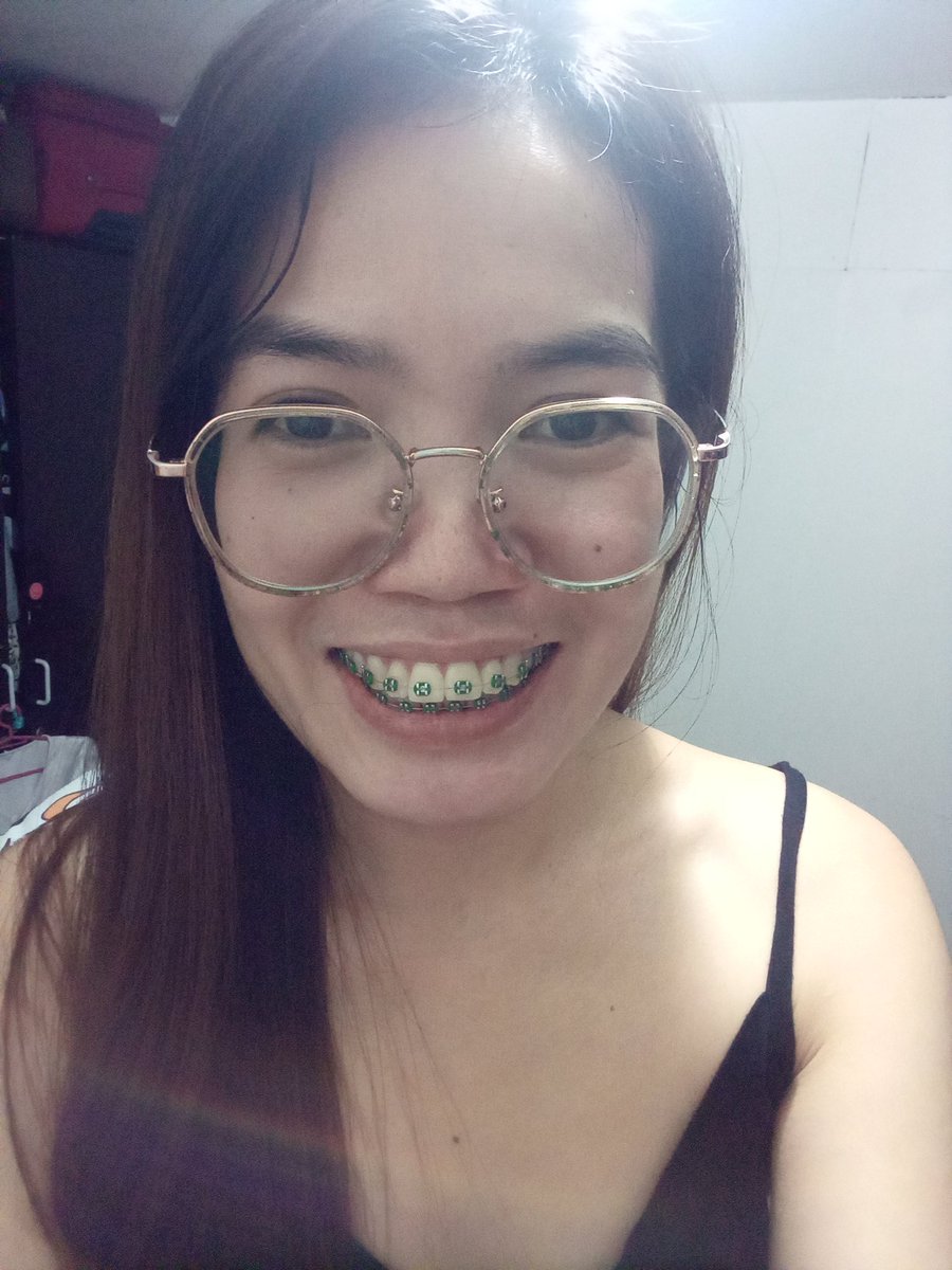 Rolieme22's tweet image. 99th day of braces 😁

#overbite