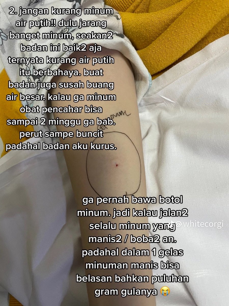 meet_aaaa's tweet photo. @Askrlfess Kbtulan ak liat vt pglmn org usia 22 kena diabetes, trs ak save buat ngingetin diri sndiri https://t.co/CeXXClNXEL