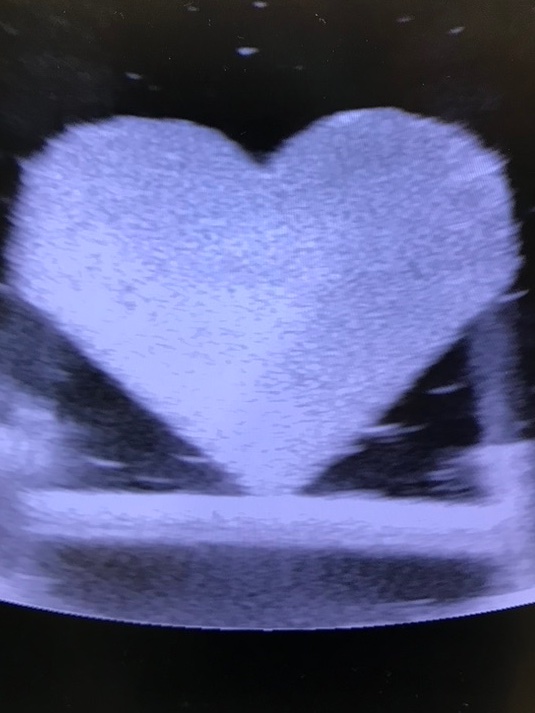 The @SongLabUIUC and <a href="/Oelze_Url/">Oelze_URL</a> labs are ready for @BeckmanInst <a href="/uofigrainger/">The Grainger College of Engineering</a> Open House! Come to our booth and enjoy some shape guessing games and many other fun activities with ultrasound. Ultrafun with Ultrasound!

beckman.illinois.edu/visit/events-a…