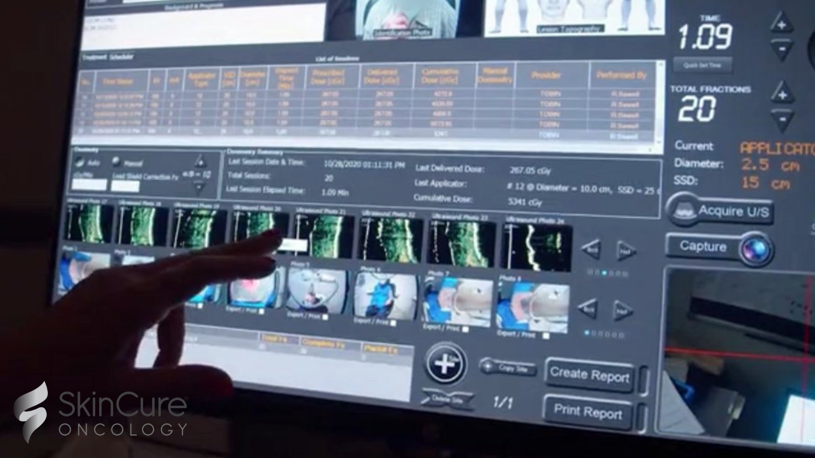 SkinCure Oncology on Twitter "Visual proof of healing for your basal