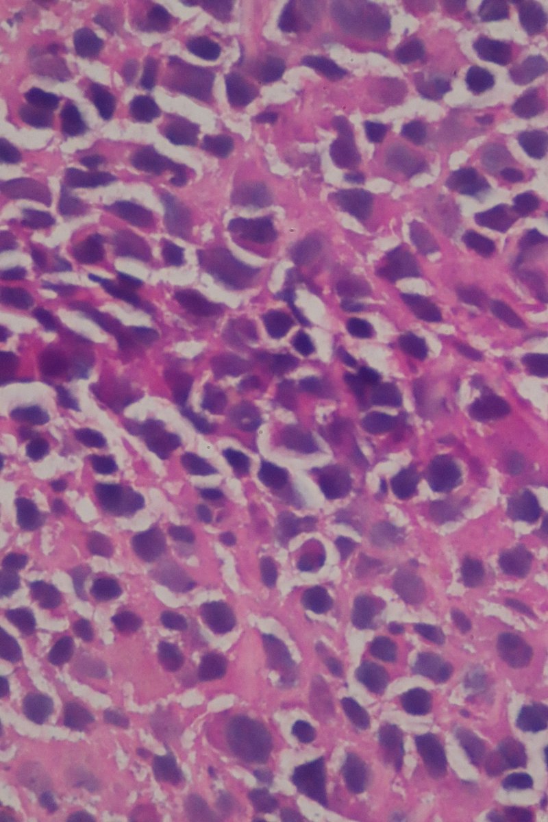 Very pretty cryostat slice - H&amp;E stained - of mouse spleen! (The only thing is that ALL RBCs somehow disappeared from the slice)