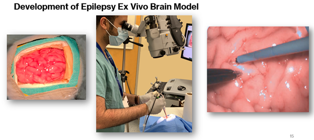 <a href="/AI_SimCentre/">Neurosurgical Simulation and AI Learning Centre</a> congratulates Nour Abou Hamdan for receving her MSc from the Department of Experimental Surgery at McGill with thesis entitled: 
Continuous Assessment of Instrument Tracking in an Ex Vivo Calf Brain Epilepsy Simulation Model. Great work Nour moving the field forward