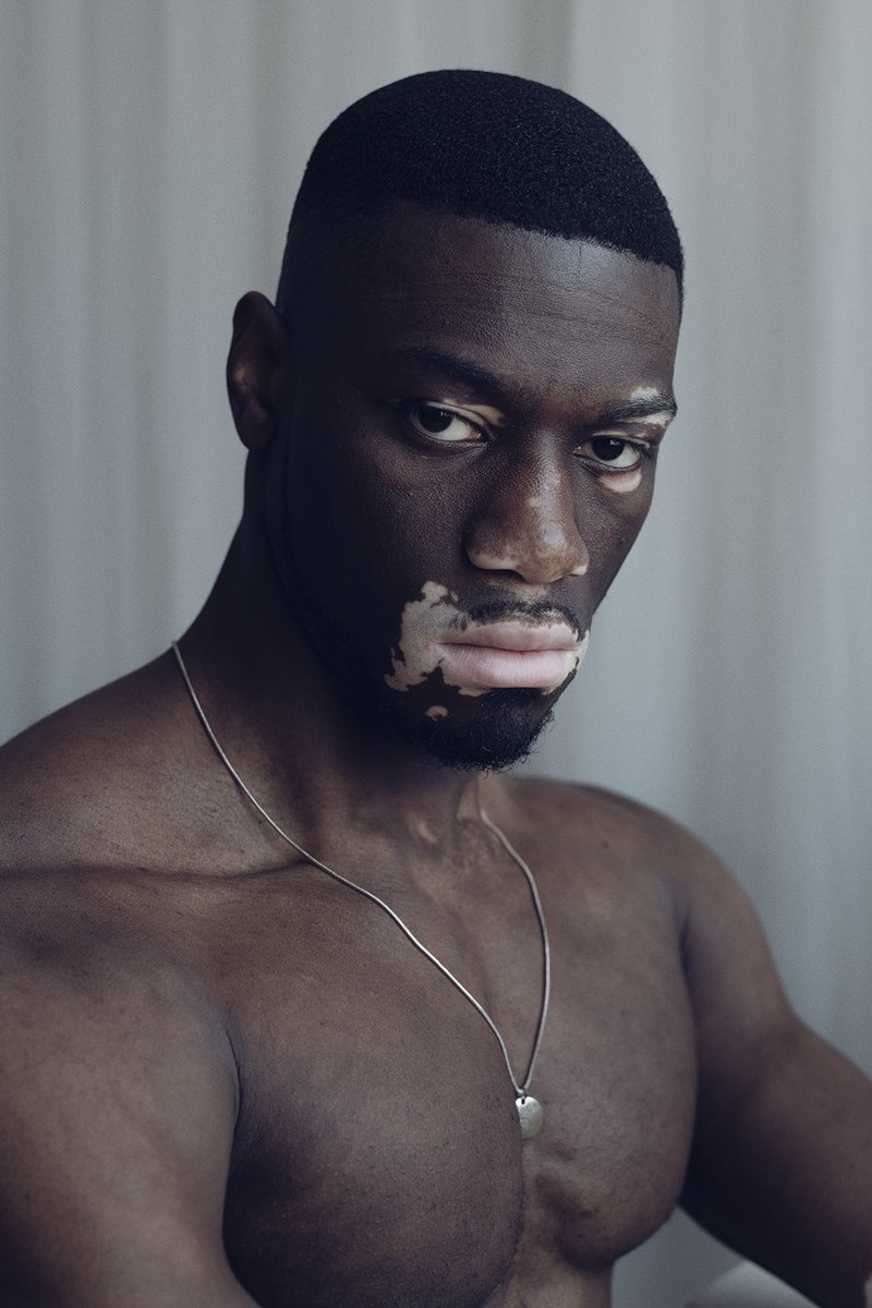 NemesisMCR's tweet photo. Reuben Sam by @saneseven 

This photograph won the prestigious Portrait of Humanity Award created by the British Journal of Photography and featured in the their 5th edition. 

#nemesismodels #modelagency #photography https://t.co/L2QTaTmaWS