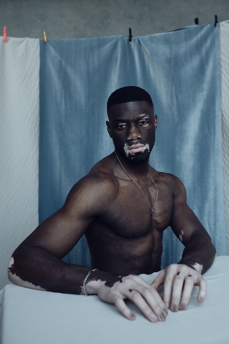 NemesisMCR's tweet photo. Reuben Sam by @saneseven 

This photograph won the prestigious Portrait of Humanity Award created by the British Journal of Photography and featured in the their 5th edition. 

#nemesismodels #modelagency #photography https://t.co/L2QTaTmaWS