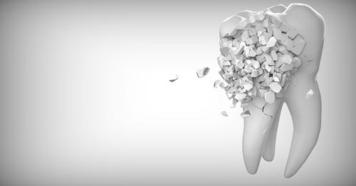 sumterdental's tweet photo. Broke a tooth in half? Ignoring it can lead to serious issues down the road. See a dentist right away to find out the best options for fixing it fast.

#dentalcare #sumterdentalcare https://t.co/U6eulM6n09