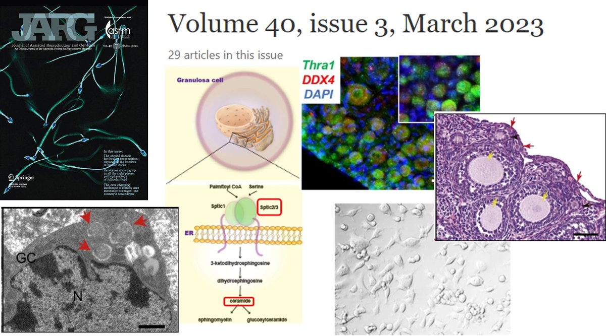 ClinMedJournals's tweet photo. #JARG 
Issue 3 is online! https://t.co/4m1ETSjc29

Some featured topics: 
▶️#Vitrification 
▶️#slow_freezing
▶️#fertility_preservation 
▶️#infertility 
▶️#DNA_damage 
▶️#microRNA 
▶️#pregnancy_loss 
▶️#US_Insurance
▶️#mosaic_diagnosis 
and more...

Info at https://t.co/Sm2xO7aYxg https://t.co/TIffa3yXI9