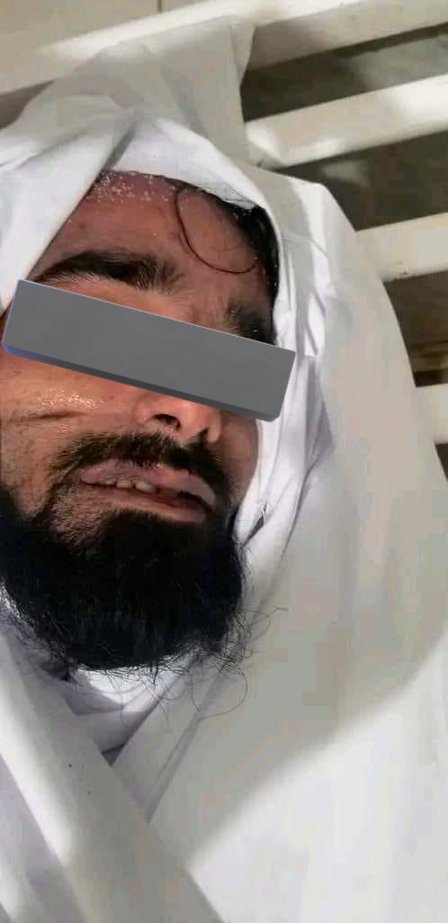 هل تذكرون حادثة مقتل السنباني وكيف أقاموا الدنيا على القوات الجنوبية والمجلس الانتقالي سّخروا القنوات والمواقع والمرتزقة لماذا لان الحادثة وقعت في الجنوب 

هل سمعتم ناشطيهم ومثقفيهم او حتى مرتزقتهم يتحدثون عن (المكحل) لا… 
 لماذا ؟ 

 لأنهم بالمختصر جبناء خونة ويخدمون الحوثي !!