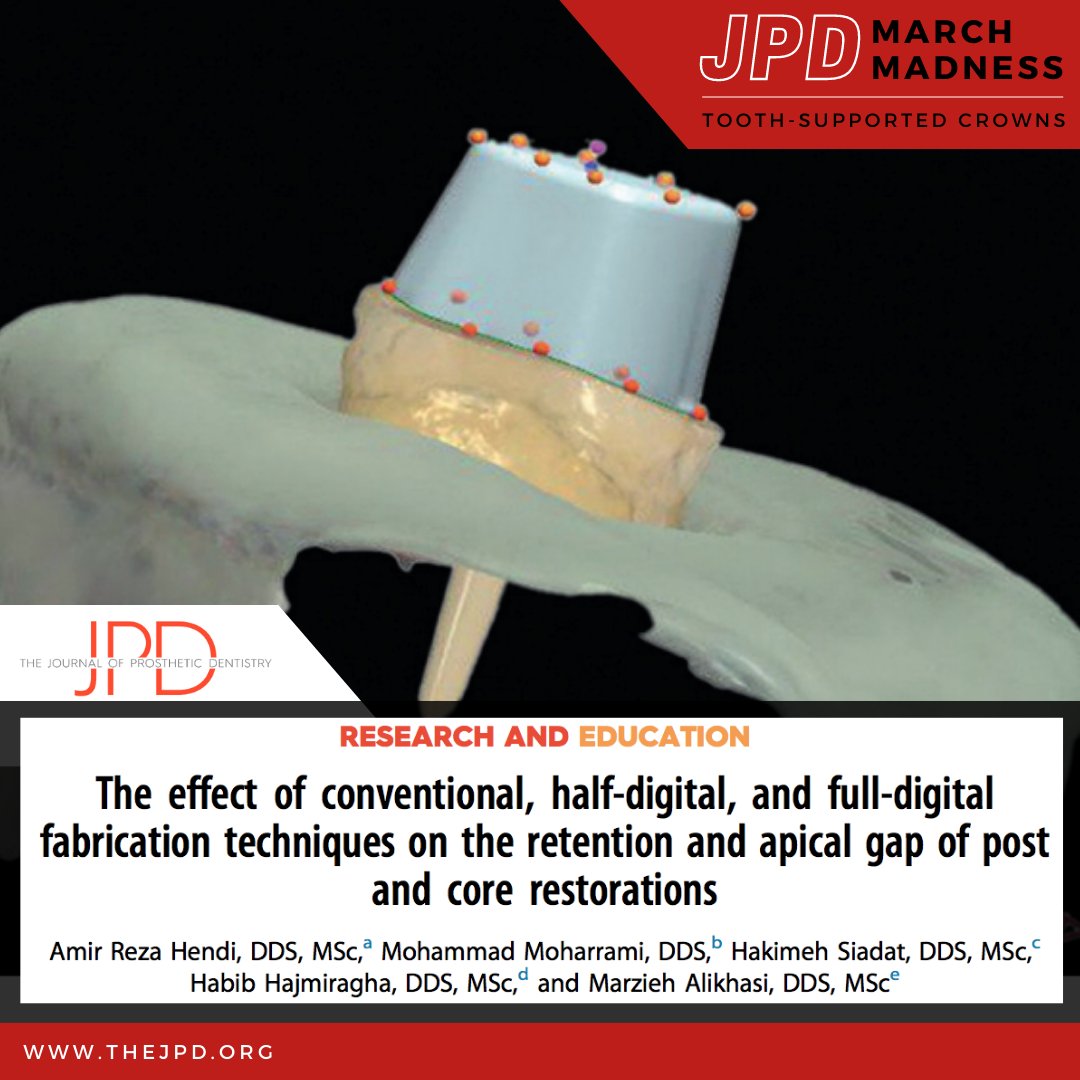 JPDentistry's tweet image. #tooth supported #dentalcrown round– Conventional, combination of conventional-digital, and fully digital methods for designing a custom #postandcore prosthesis are used. The resulting prostheses are compared for their retention and accuracy of fit: thejpd.org/article/S0022-…