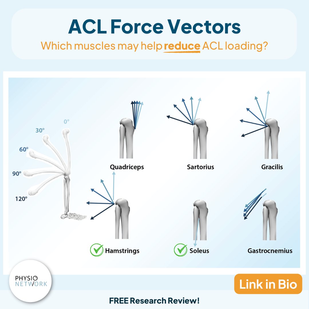 PhysioNetwork's tweet photo. 🦵 Which muscles may help reduce the load on the ACL?

🔎 A great new paper by Maniar et al (2022) looked at how different muscles contribute to ACL loading

👉🏻 We got @TeddyWillsey to review their paper for you
⁠
✅ Read his review for FREE here now:

🔗 https://t.co/MnXU4V9Xkj https://t.co/0OFzt6lZHz