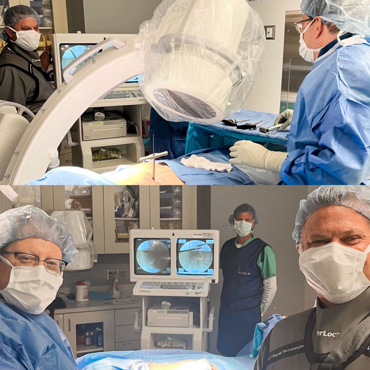 CornerLoc's tweet photo. Dr. Badawy is helping his patients suffering from chronic SI joint pain and dysfunction, one SI joint fusion at a time‼️ TransLoc 3D™ allows Dr. Badawy the flexibility to create the ideal solution for his chronic SI joint dysfunction patients. https://t.co/D1kvncWdBw https://t.co/bvXVhhhtAm