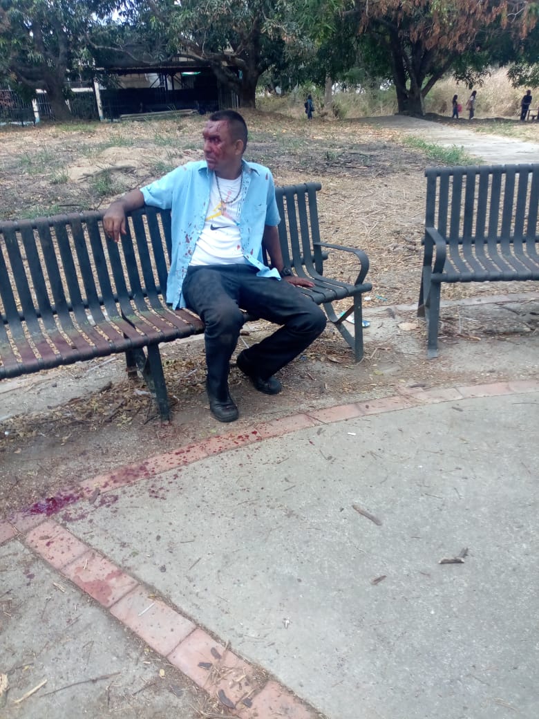 SheaEstradaxox's tweet photo. Recientemente la universidad de Carabobo ha presentado problemas de transporte que van desde siniestros con transportes privados que trabajan como rutas clandestinas de la universidad, hasta casos de violación y acoso por parte transportistas. #UC #Todossomosuc https://t.co/F9T3xgg4si