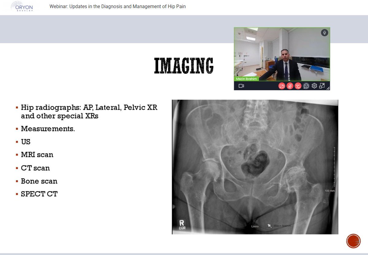 Did you enjoy our webinar: "Updates in the Diagnosis and Management of Hip Pain"?

Thank you Mr Mazin Ibrahim for your time and knowledge ⭐

We hope you learned something new. 📚
🖱 Check out our website to see what other courses we offer: loom.ly/wM__vok