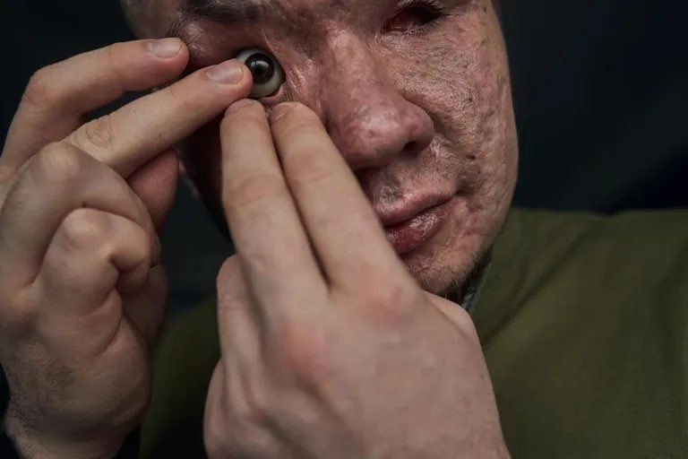 TreasChest's tweet photo. 💔A Ukrainian sapper lost both eyes after the explosion of an anti-personnel mine

Vladyslav voluntarily went to fight in the first weeks of the full-scale invasion. The man joined the sappers.

According to his commander, who saw the incident, the man miraculously survived.

Vladyslav is supported by his fiancée Valeria. Now the couple will learn about all possible experimental ways to restore vision.

We wish Vlad health 🙏

📷: Vladyslav and Kostyantyn Liberov

Channel 24