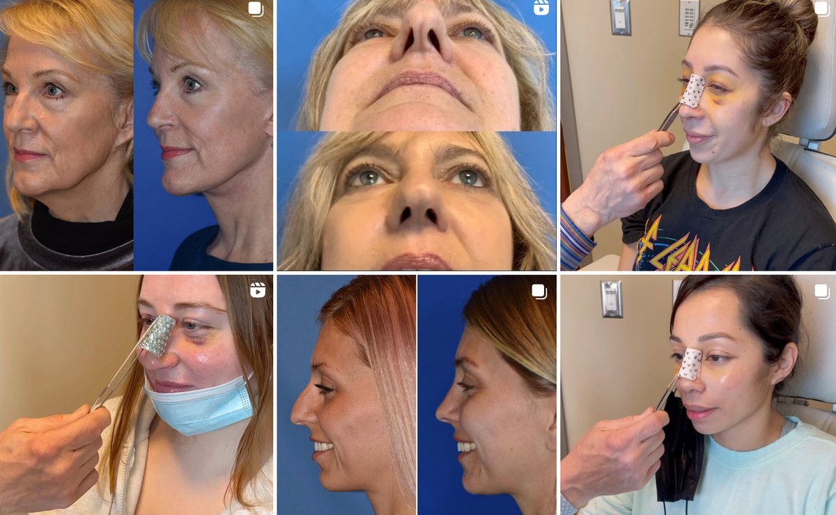 Plastic and Cosmetic Surgery Services – Plastic and Cosmetic Surgery Services calendar.google.com/calendar/embed…