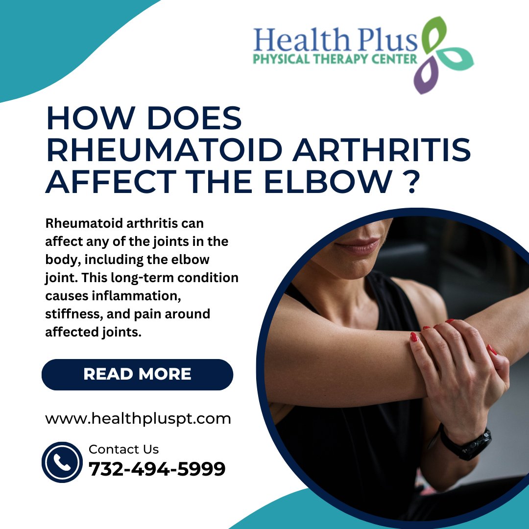 Health Plus Physical Therapy & Rehabilitation Center can help treat your elbow arthritis. Read here: bit.ly/3bPKxl3

#healthpluspt  #painrelief  #ElbowPain  #elbowinjury #elbowexercises #physiotherapy #fitness #physicaltherapist #physio #rehab #health #physiotherapist