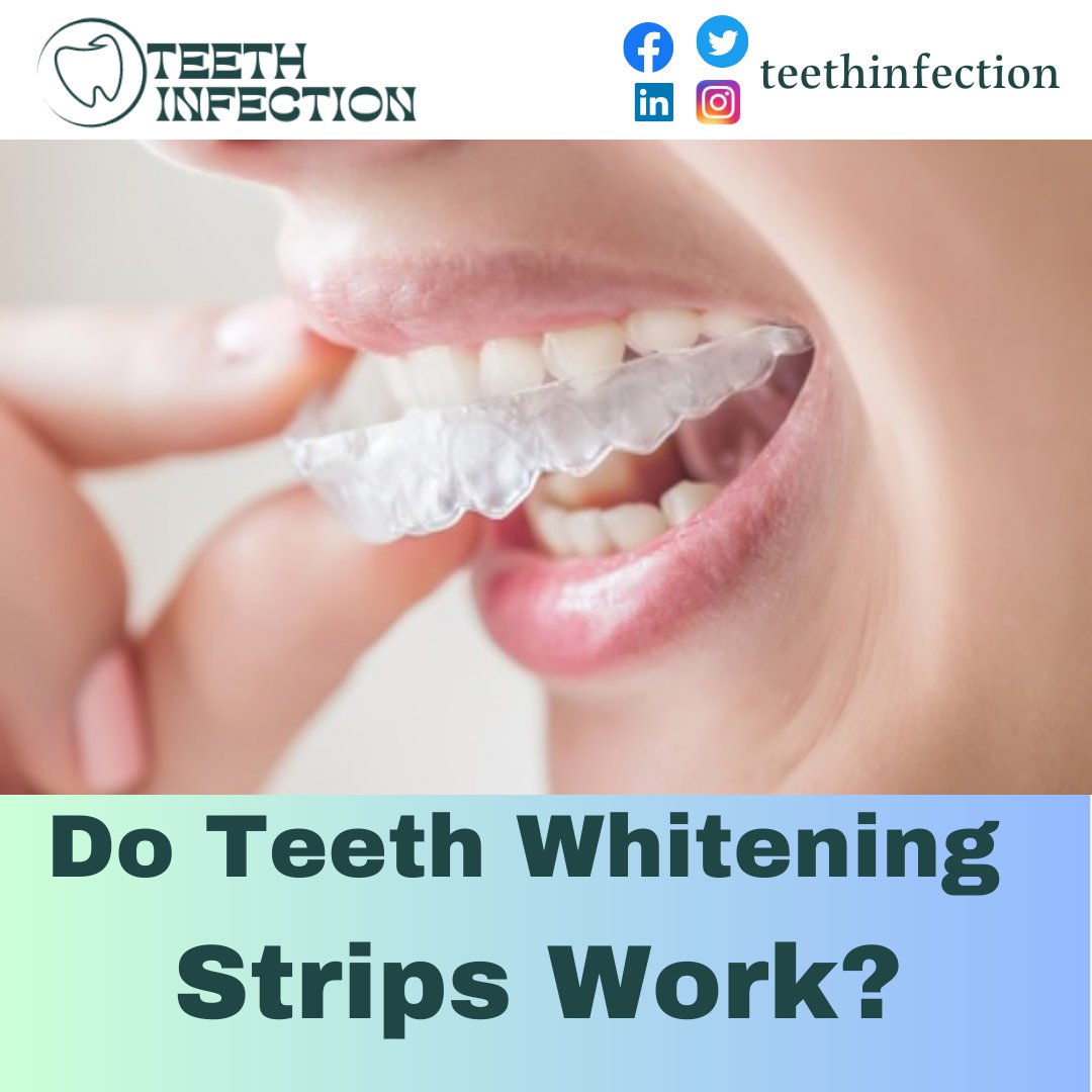 TOPIC : Do teeth whitening strips work?

Read Full Blog : teethinfection.com/do-teeth-white…

#TeethWhiteningStrips #TeethWhitening #OralHygiene #BrightSmile #WhiteTeeth #DentalCare #CosmeticDentistry #HealthySmile #AtHomeWhitening #ProfessionalWhitening #SmileMakeover #ConfidenceBoost